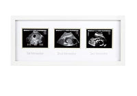 Trimester sonogram frame for pregnancy milestone keepsakes - Awaiting the Stork