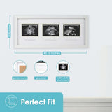 Trimester sonogram frame for pregnancy milestone keepsakes - Awaiting the Stork