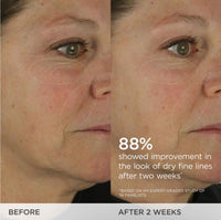 Before and after results of a skincare treatment showing improved dry fine lines after two weeks, 88% improvement noted.